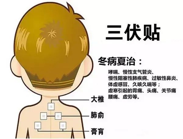 2、三伏貼的功能和功效是什么？